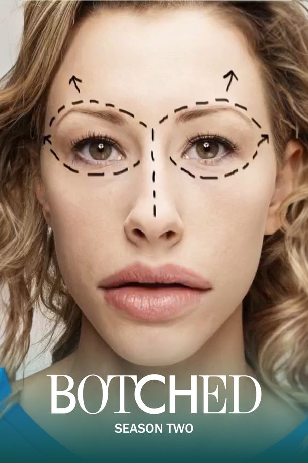 拙劣    第⁨二⁩季
    Botched (2015)